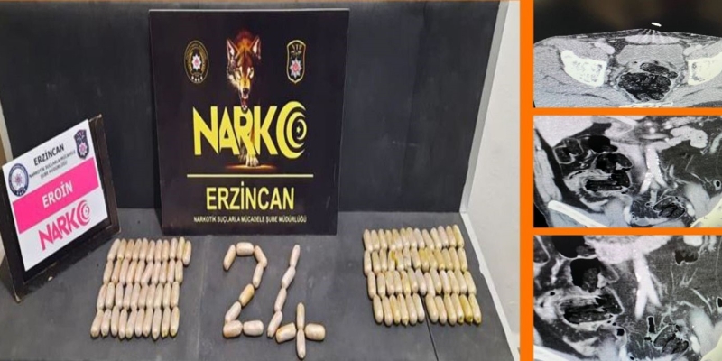Erzincan polisinden çarpıcı operasyon: Midelerinde 109 ölüm kapsülü